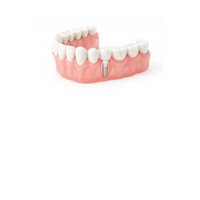 ĐIỀU TRỊ VÀ PHẪU THUẬT RĂNG MIỆNG